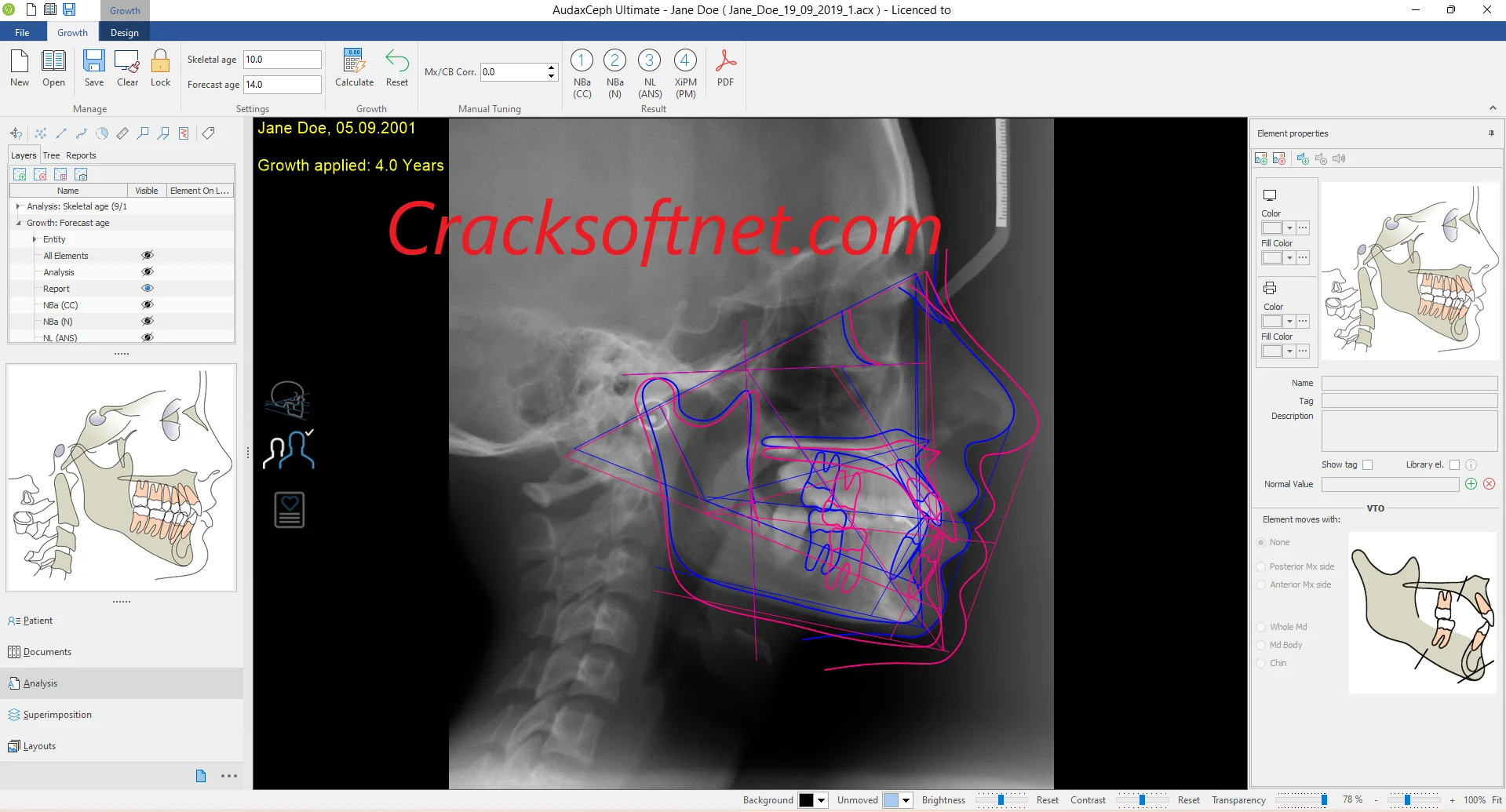 AudaxCeph 6.6.12.4731 Ultimate crack full modules