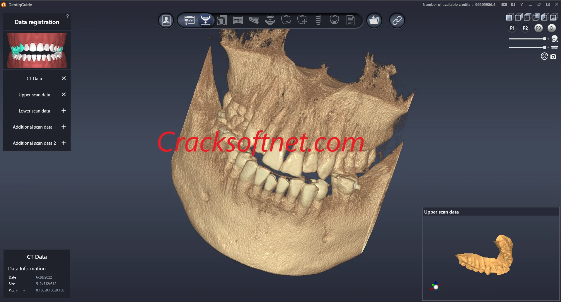 DentiqGuide 1.3.05 Full Version Crack